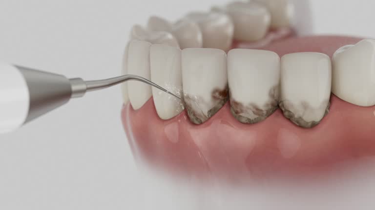 Reliable Dental Implants contractor in Albany, WI by Smile Center Dentistry